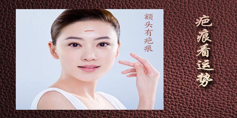额头有疤会影响命运吗（额头疤痕是否与命运有关）
