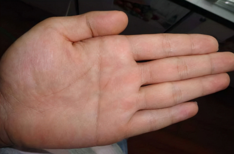 男生右手断掌纹有什么说法（解读男性右手手掌断裂纹的预测与解释）