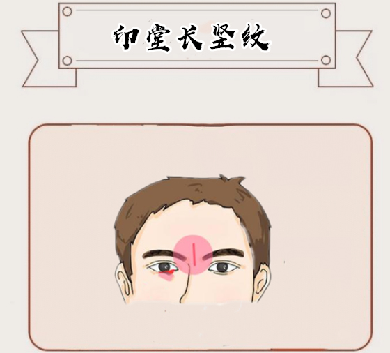 男人印堂有一竖纹征兆（分析男性印堂竖纹所代表的预兆）