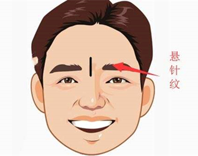 额头上有竖纹好不好（评估额头上竖纹对命运的影响程度）