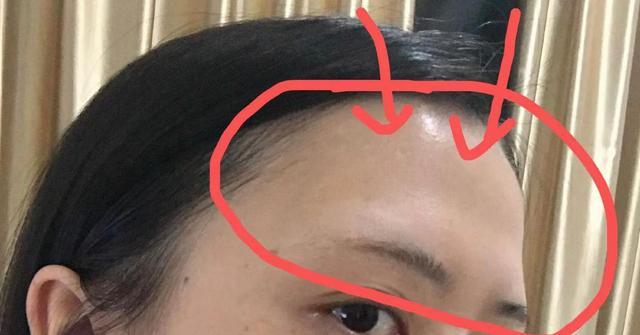 额头中间有凹陷代表什么（详解额头中凹陷所象征的潜在意义）